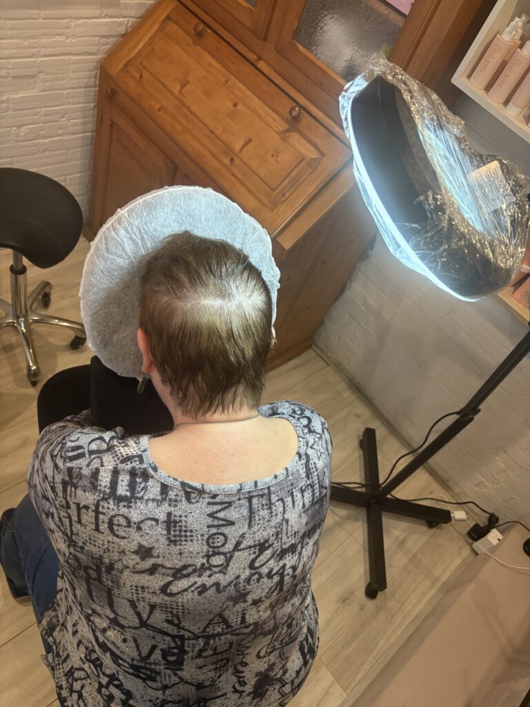 micro haar pigmentatie bij mhp westland